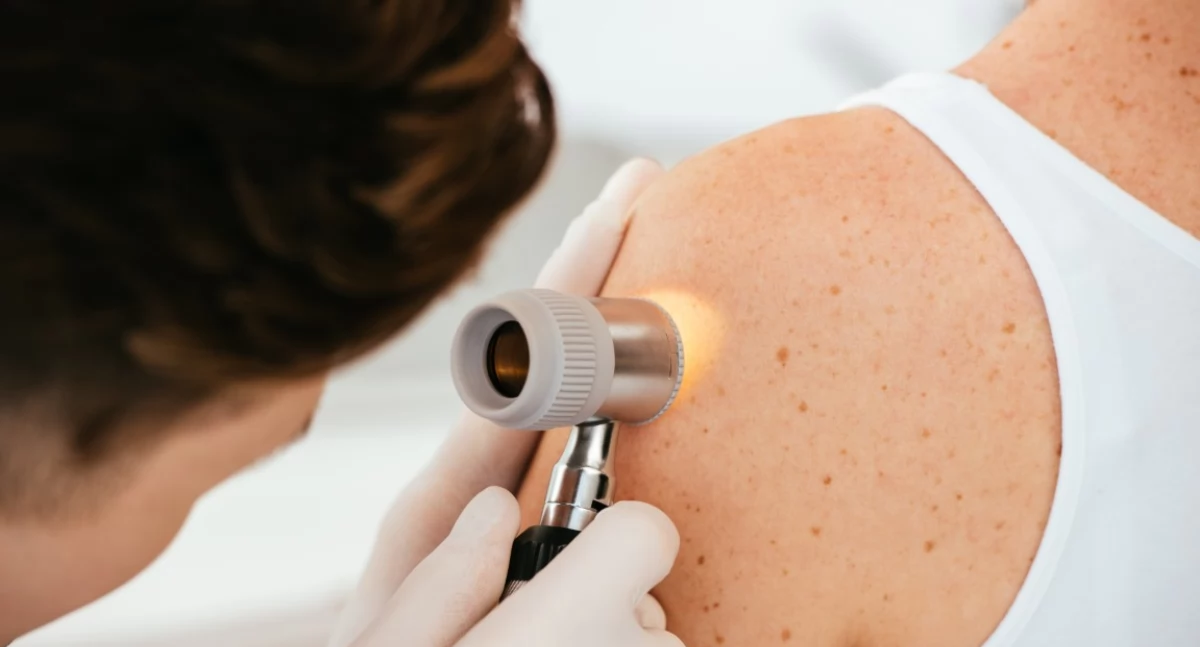 Zdrowie Uroda Szpital, wygląda pierwsza wizyta dermatologa Kompleksowy przewodnik Panów - zdjęcie, fotografia